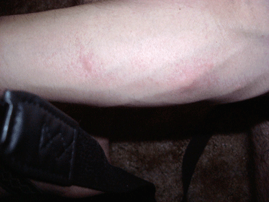 I was clearing out some dead leaves from the pots and my arm started to break out about 10 minutes later.  Guess my skin is a little sensitive to the oils or the little hairs on the stems.